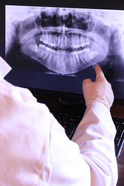 Best Broken or Cracked Tooth Emergency Dentist in St Leon, IN