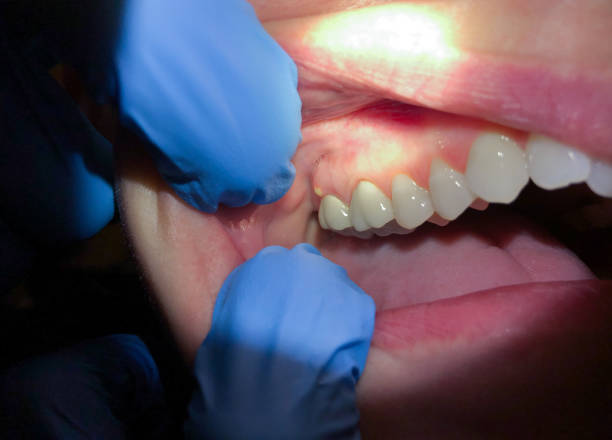 Best Emergency Dentist for Special Needs Patients in St Leon, IN