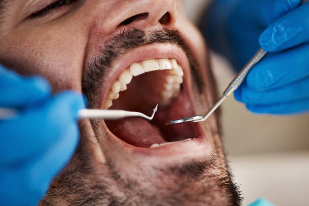 Best Emergency Dentist for Knocked-Out Tooth in St Leon, IN